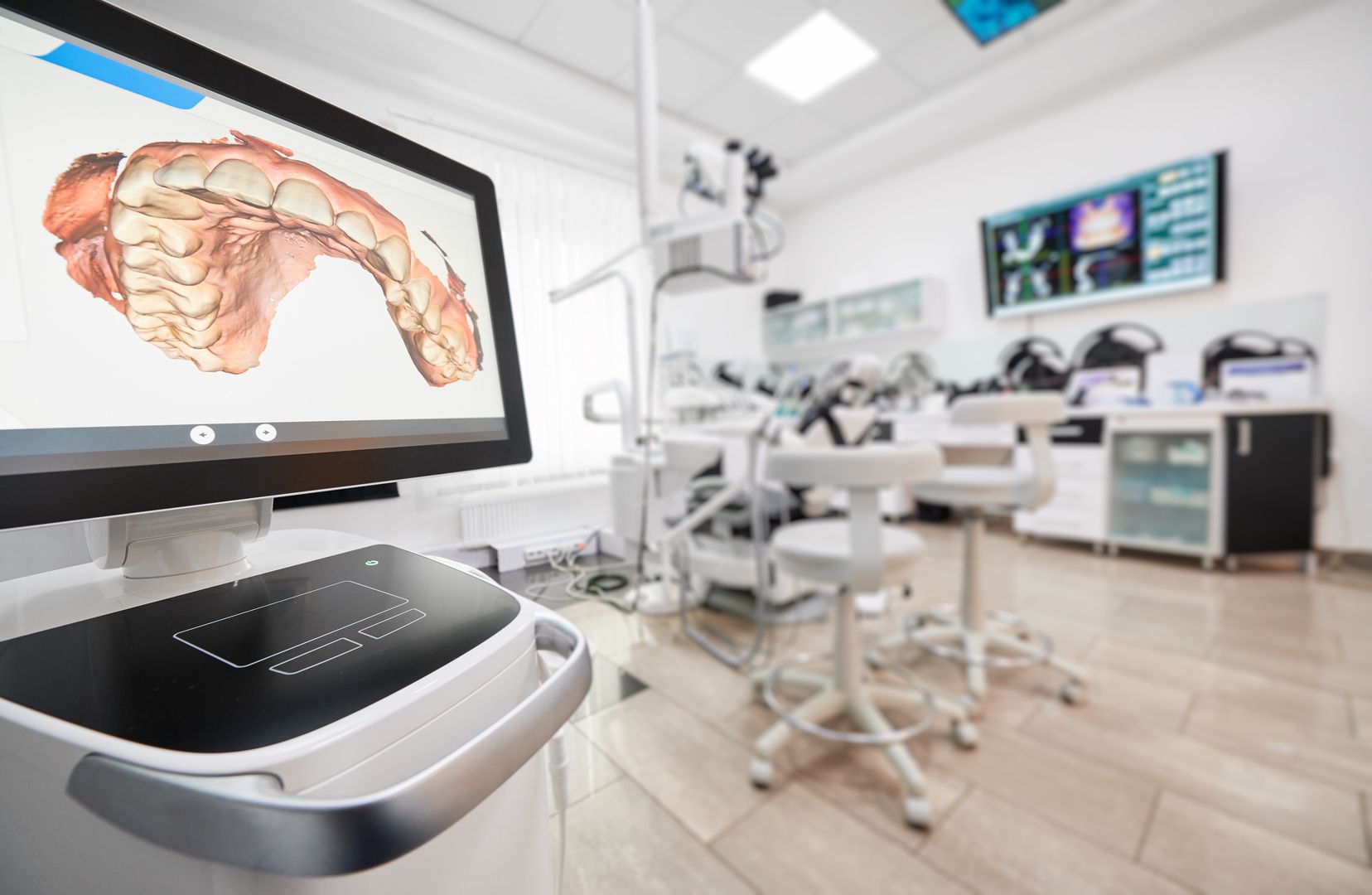 3D Scan von einem Gebiss
